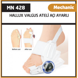 Hallux Valgus Ateli Açı Ayarlı